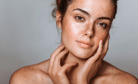 pigmentation