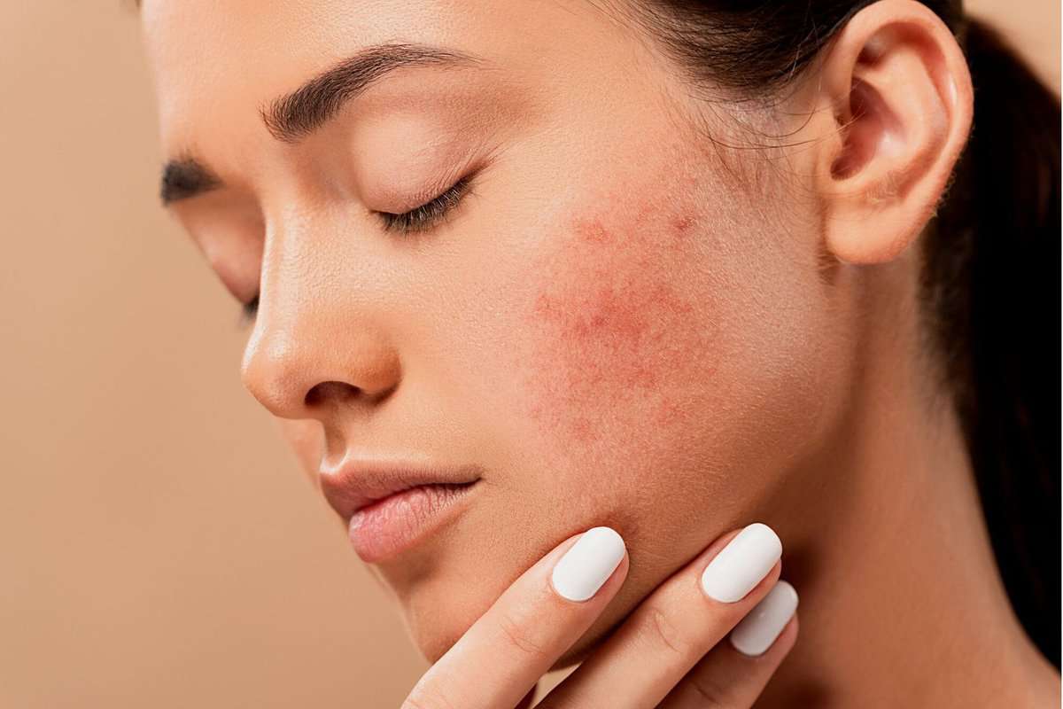 skin