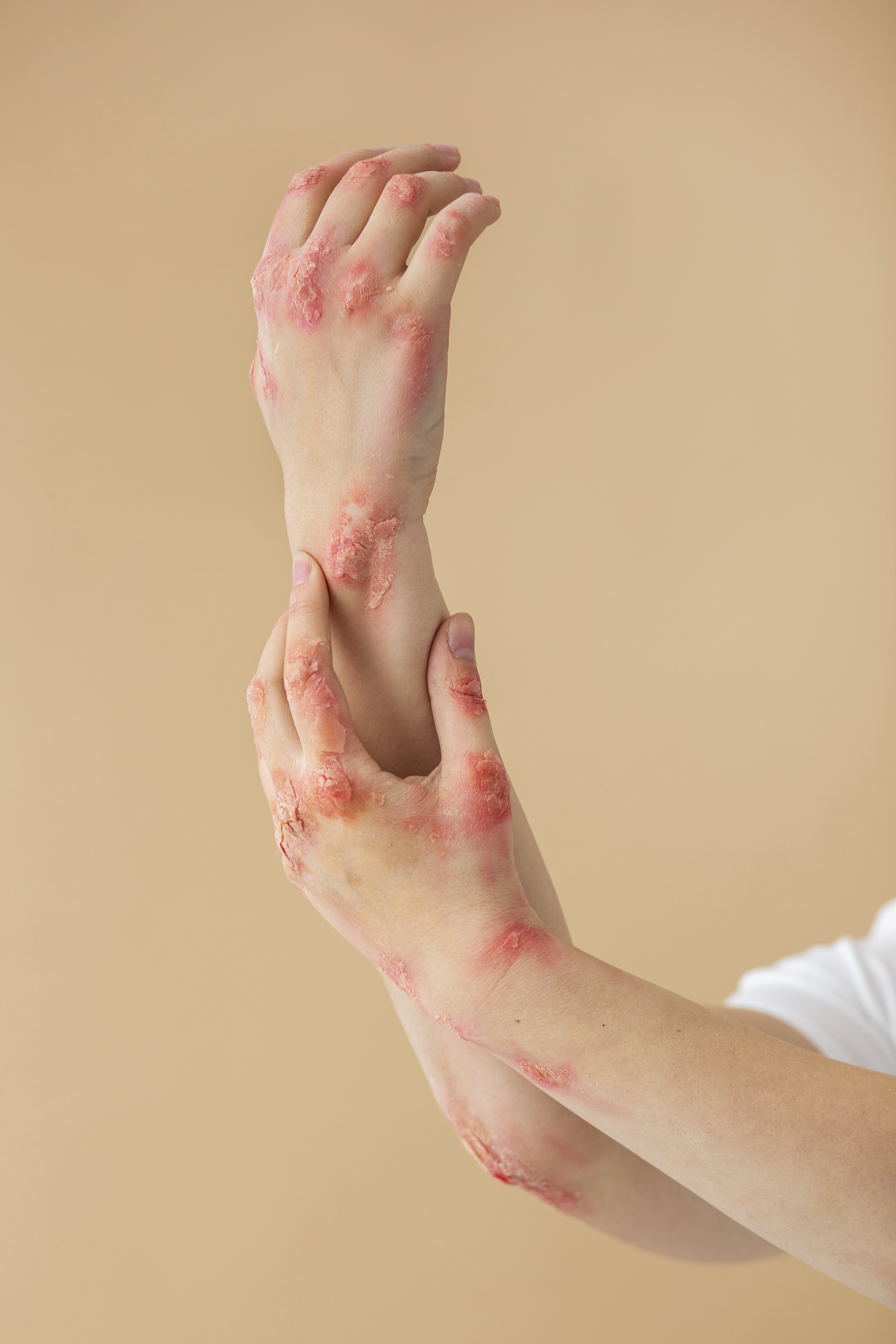 injuries