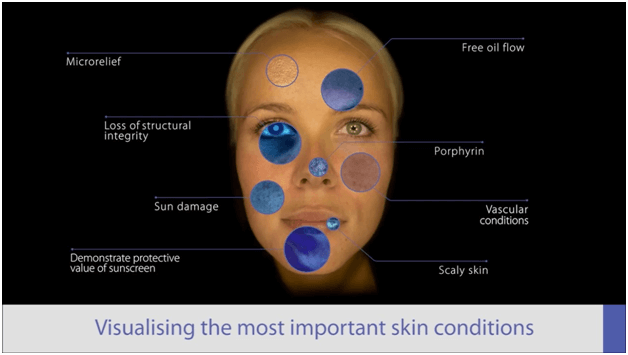 skin