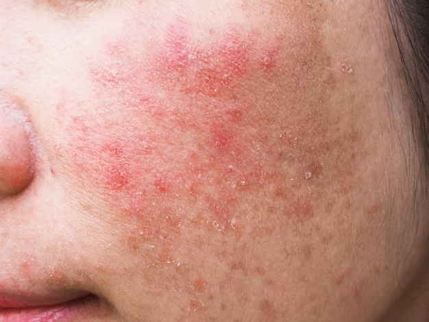 epidermalme
